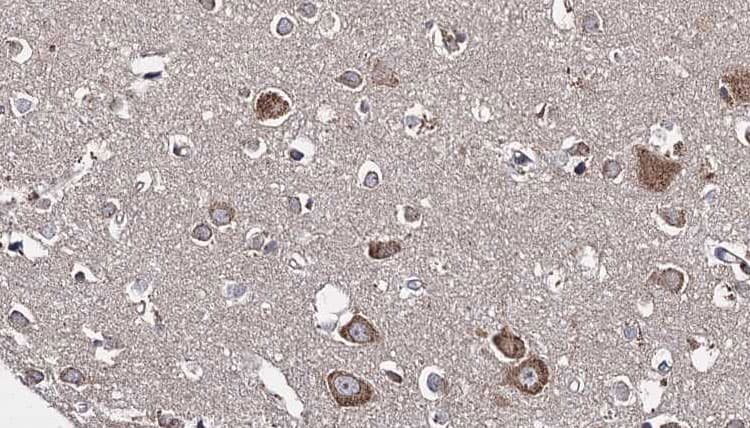 Polyclonal Rabbit anti-Human KLC1 / Kinesin Light Chain 1 Antibody (IHC, IF, WB)