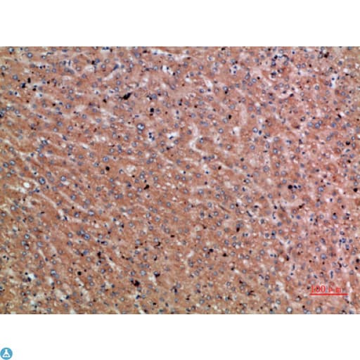 Polyclonal Rabbit anti-Human Chordin Antibody (IHC)