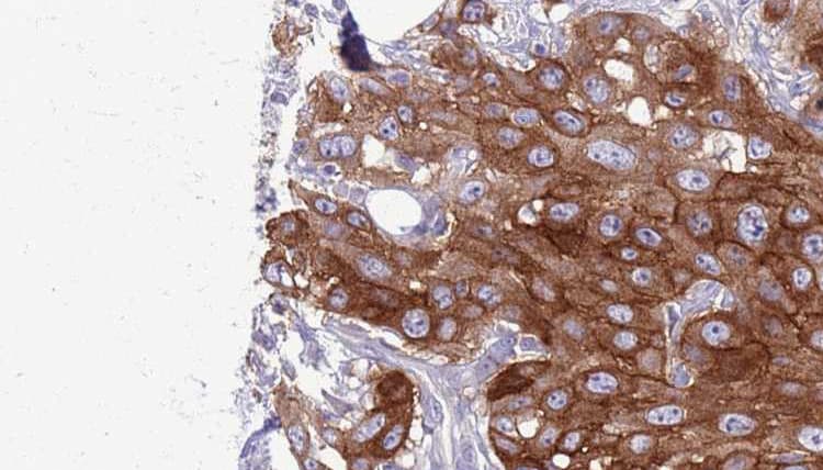 TNFRSF14 / CD270 / HVEM Antibody