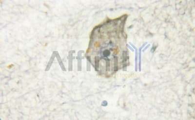NTRK2 / TRKB Antibody