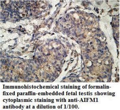 AIFM1 / AIF / PDCD8 Antibody (aa517-531)