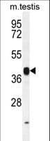 INHBB / Inhibin Beta B Antibody (aa369-397)