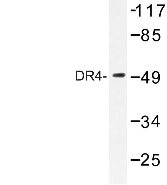 TNFRSF10A / DR4 Antibody (Asp430)
