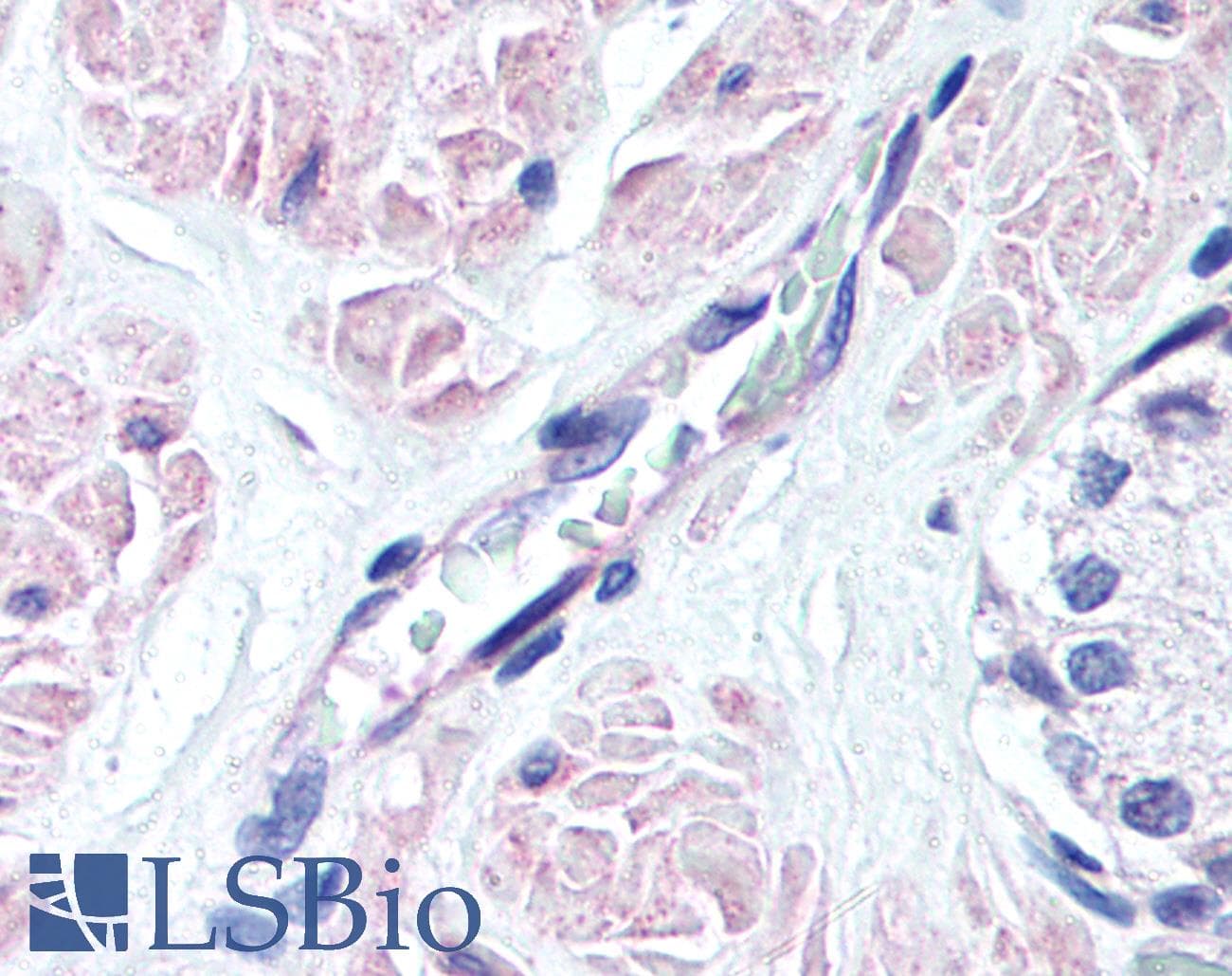 IHC-plus™ Polyclonal Rabbit anti-Human SIPR3 / EDG3 / S1P3 Antibody (aa12-25, IHC, WB)