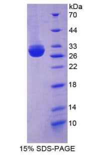 Human MPP5 Protein (Recombinant His-T7)