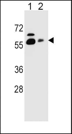 Polyclonal Rabbit anti-Human SLC23A1 / SVCT1 Antibody (aa1-30, IHC, WB)