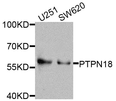 PTPN18 Antibody
