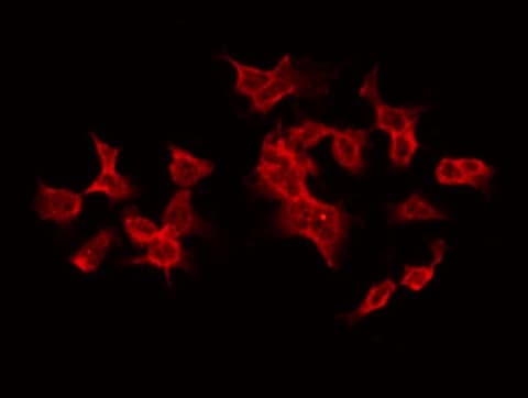 TANK Antibody