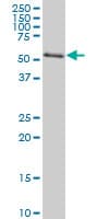 AKT2 Antibody (clone X1)