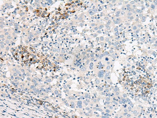 Polyclonal Rabbit anti-Human GCAP2 / GUCA1B Antibody (IHC, WB)