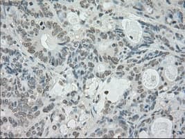 SATB1 Antibody (clone OTI13D6)
