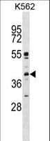 MAPK11 / SAPK2 / p38 Beta Antibody (aa133-161)