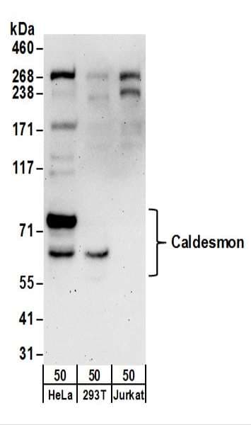 CALD1 / Caldesmon Antibody (aa500-550)