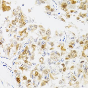 MYO5A / Myosin V Antibody