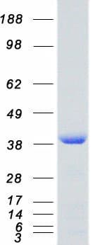 Human SET / TAF-I Protein (Recombinant Myc-DDK (Flag))