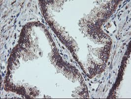 Monoclonal Mouse anti-Human PPP1R15A / GADD34 Antibody (clone OTI4F1, IHC, IF, WB)