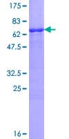 Human VRK1 Protein (Recombinant GST)