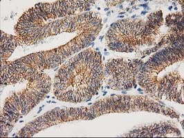 CTNNB1 / Beta Catenin Antibody (clone OTI12H7)