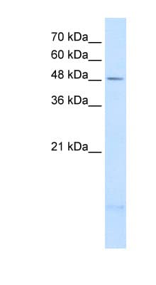 PSD3 Antibody (aa67-116)