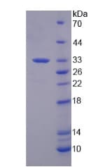 Human SF3B1 Protein (Recombinant His, N-Terminal)