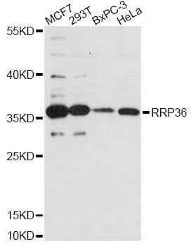 RRP36 Antibody