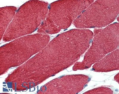 IHC-plus™ Muscle Actin Antibody (clone HHF35)