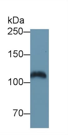 EGFR Antibody (aa319-484, APC)