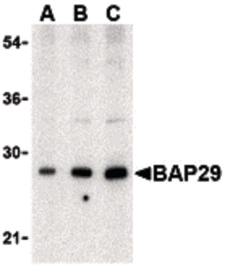 IHC-plus™ Polyclonal Rabbit anti-Human BAP29 / BCAP29 Antibody (IHC, IF, WB)