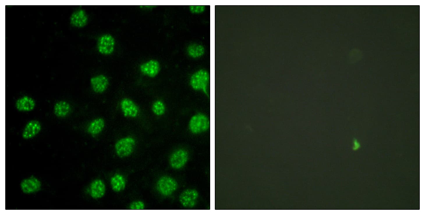 PRKDC / DNA-PKcs Antibody (aa2613-2662)
