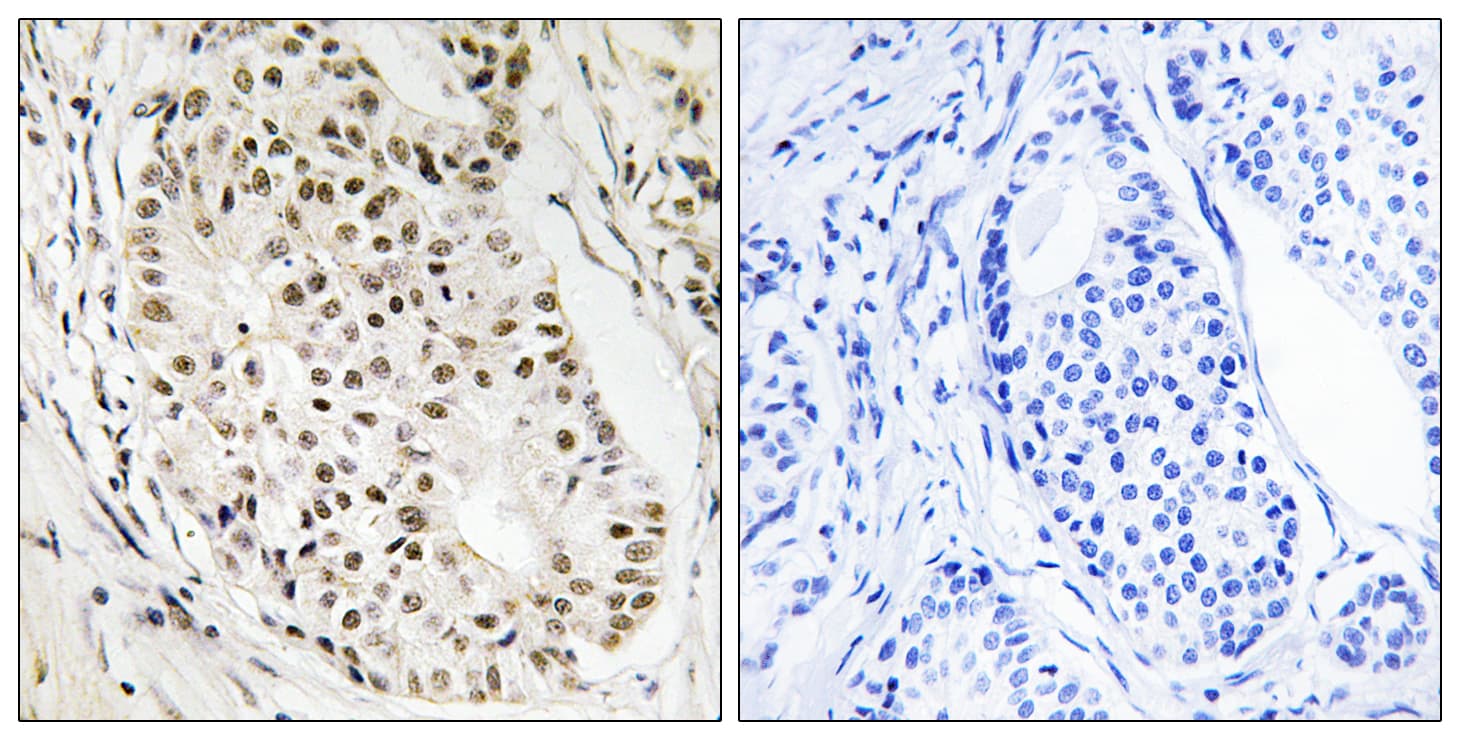 Polyclonal Rabbit anti-Human HNRNPUL2 Antibody (aa601-650, IHC)