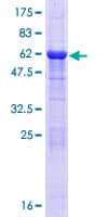 Human ADPRH / ARH1 Protein (Recombinant GST)
