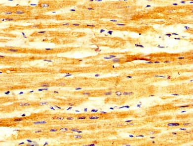 Polyclonal Rabbit anti-Human FASTKD2 Antibody (IHC, WB)