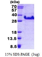 Human FXYD5 / Dysadherin Protein (Recombinant His)
