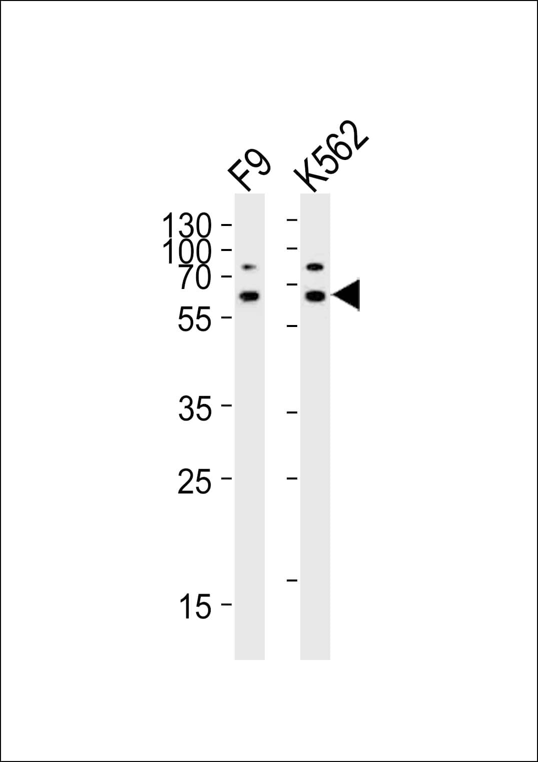 Polyclonal Rabbit anti-Human ASH2L / ASH2 Antibody (aa237-270, WB)