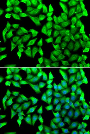 VTI1B Antibody