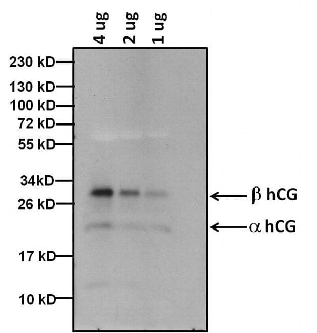 hCG / Chorionic Gonadotropin Antibody (clone SC1)