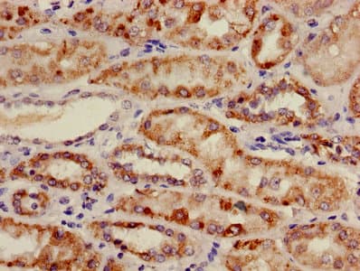 MCAD / ACADM Antibody