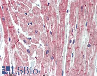 IHC-plus™ NPRA / NPR1 Antibody