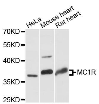 MC1R Antibody