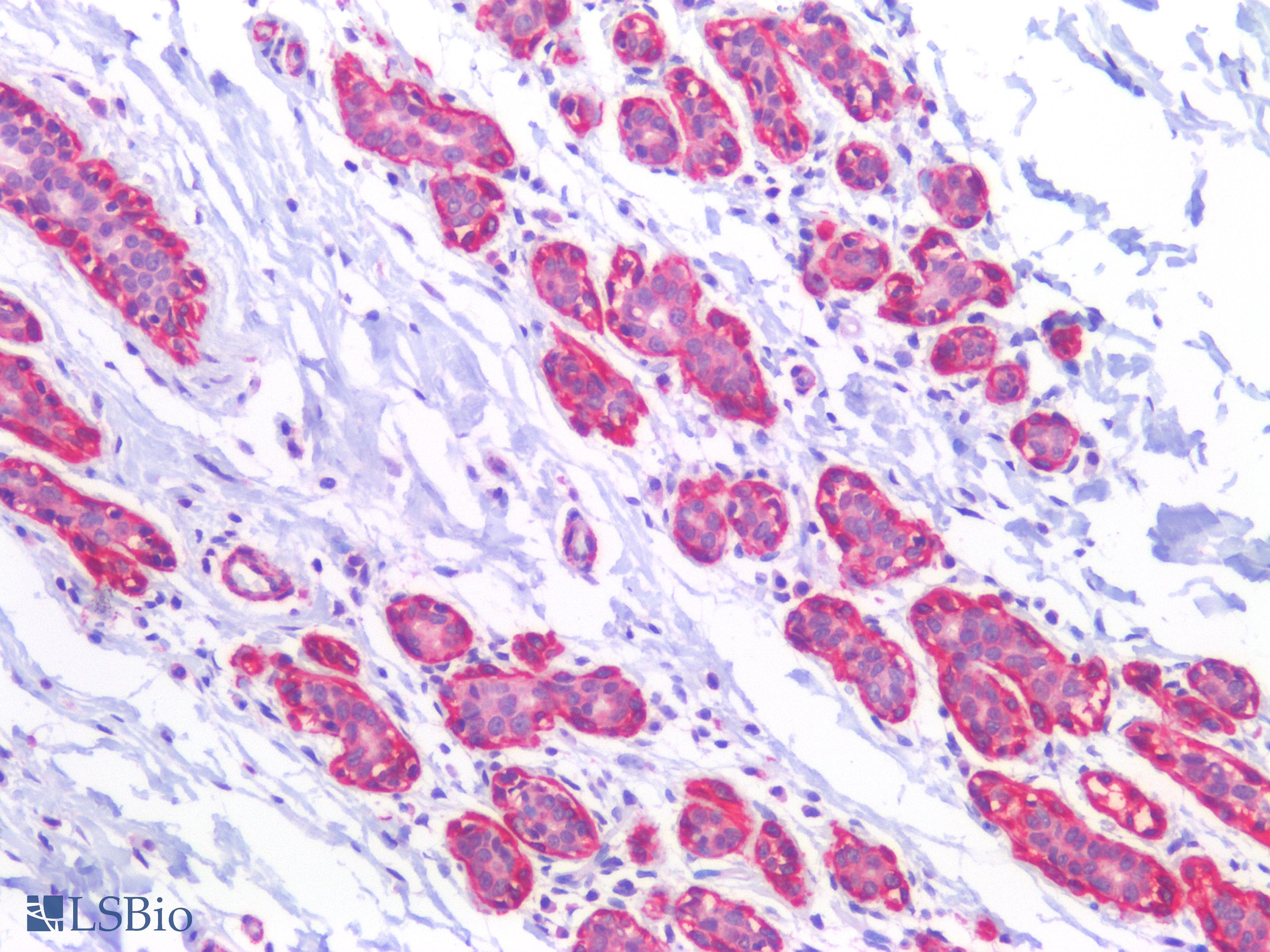 PathPlus™ Polyclonal Rabbit anti-Human ACTA1 / Skeletal Muscle Actin Antibody (IHC, WB)
