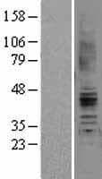 AGTR2 / AT2 Receptor Protein (Over-Expression Lysate Myc-DDK (Flag))