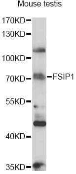 Polyclonal Rabbit anti-Human FSIP1 Antibody (WB)