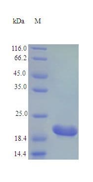 Mouse CTF1 / Cardiotrophin-1 Protein (Recombinant)