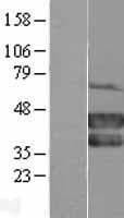 PCGF2 / MEL-18 Protein (Over-Expression Lysate Myc-DDK (Flag))