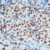 Monoclonal Mouse anti-Human MITF Antibody (IHC, WB)