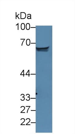 ALK3 / BMPR1A Antibody (aa24-152)