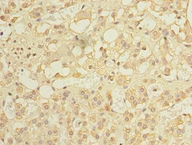 Polyclonal Rabbit anti-Human MCM9 Antibody (IHC, WB)
