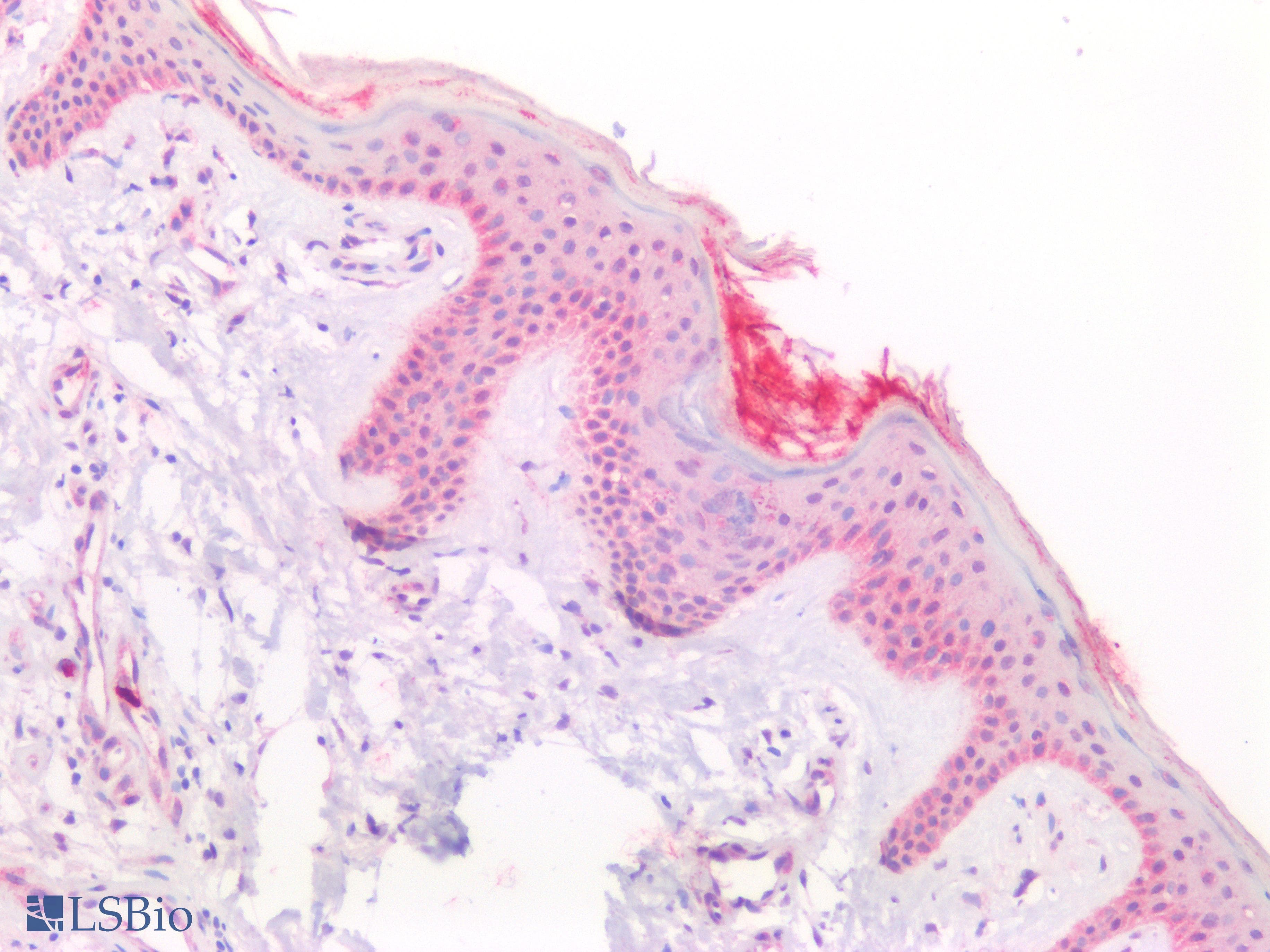 PathPlus™ Polyclonal Rabbit anti-Human LCN2 / Lipocalin 2 / NGAL Antibody (IHC, IF, WB)