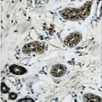 TUBB3 / Tubulin Beta 3 Antibody