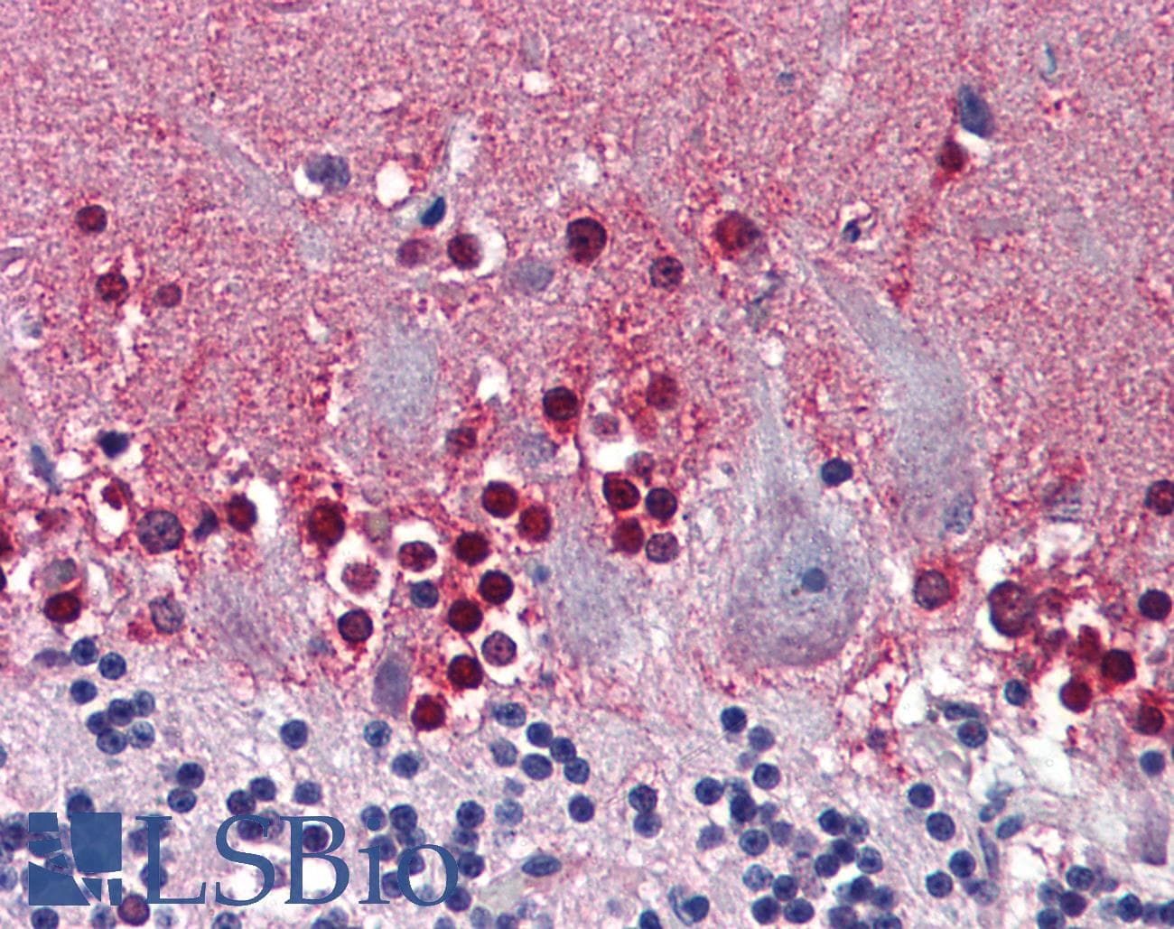 IHC-plus™ Monoclonal Mouse anti-Human CBS Antibody (clone 6A9, IHC, WB)
